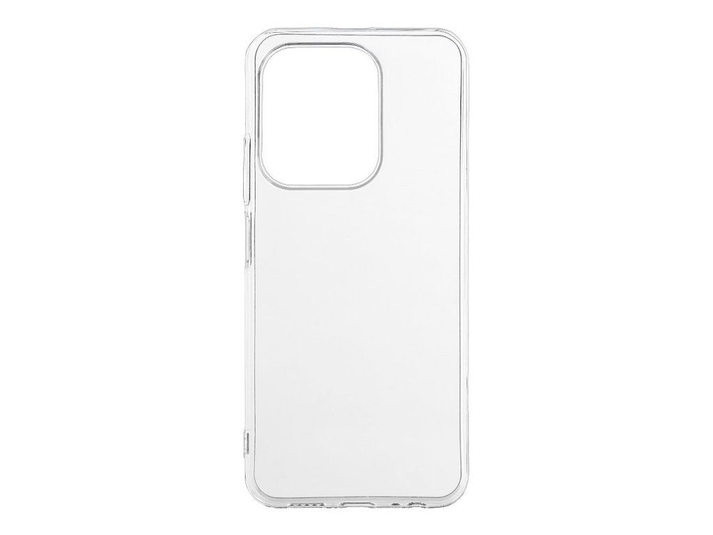 TPU kryt pre Xiaomi Redmi 17C 5G, OBAL:ME, Transparentný – detail 1